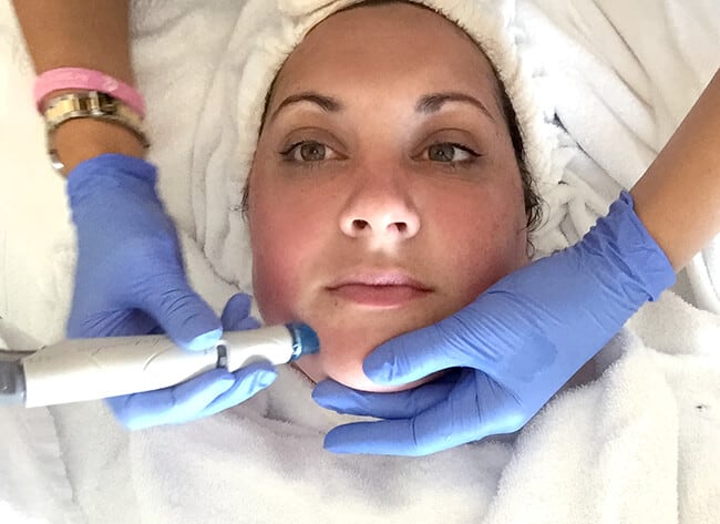 CosmetiCare Hydra Facial Newport Beach